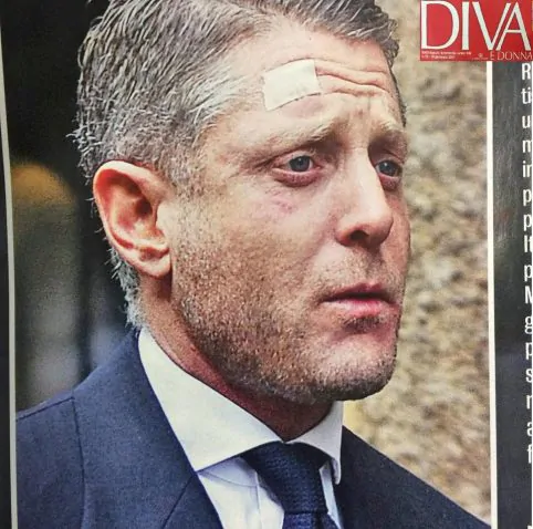 lapo elkann2