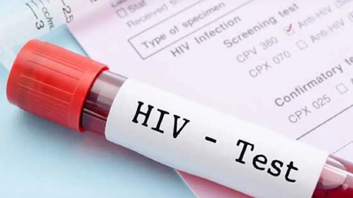 test hiv