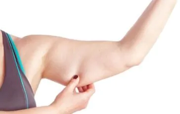 Cellulite sulle braccia: come risolvere naturalmente