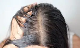 Capelli bianchi: le soluzioni migliori per mascherarli